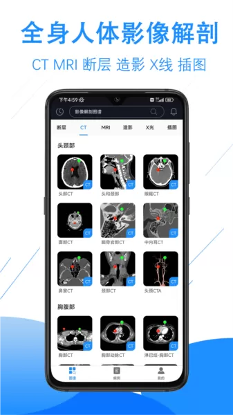 影像解剖图谱app