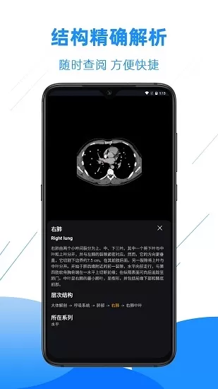 影像解剖图谱app